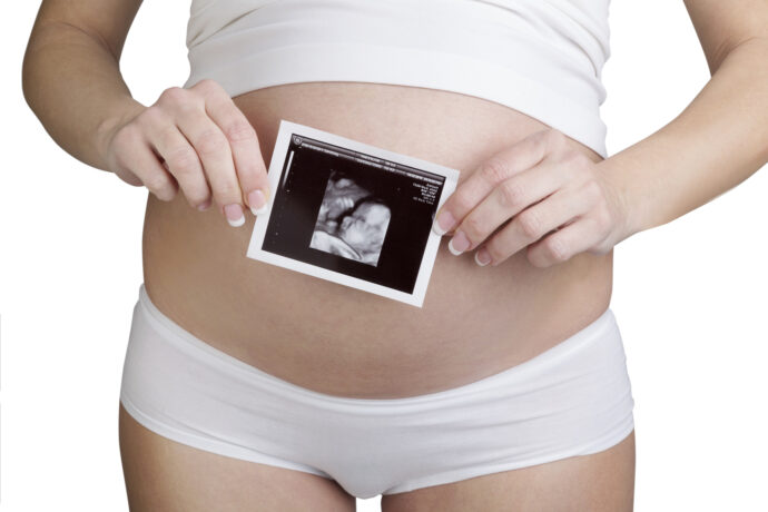 Dopplersonographie Schwangerschaft