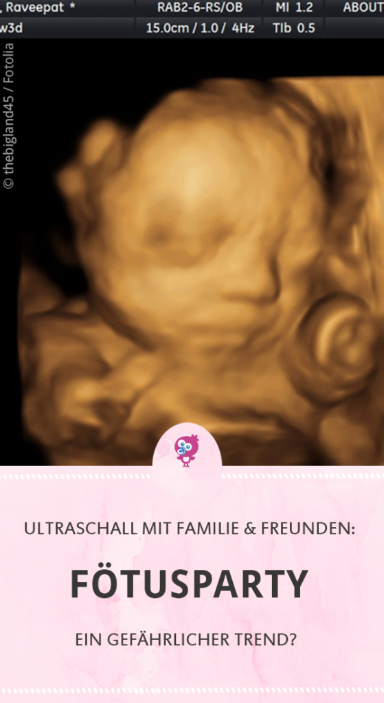 Fötusparty Babywatching - Ultraschall mit Freunden und Familie - ein gefährlicher Trend #ultraschall #schwangerschaft 