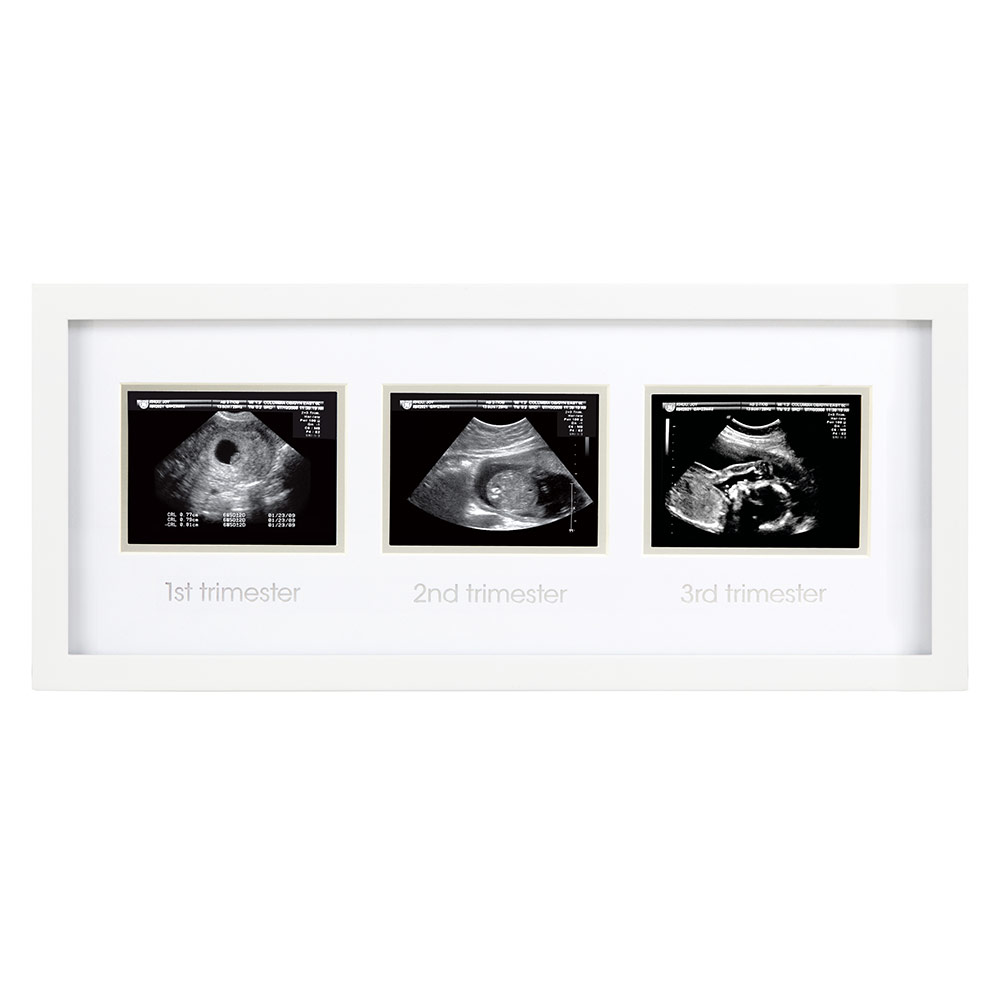 pearhead bilderrahmen ultraschallbilder, bilderrahmen schwangerschaft, bilderrahmen ultraschallbilder