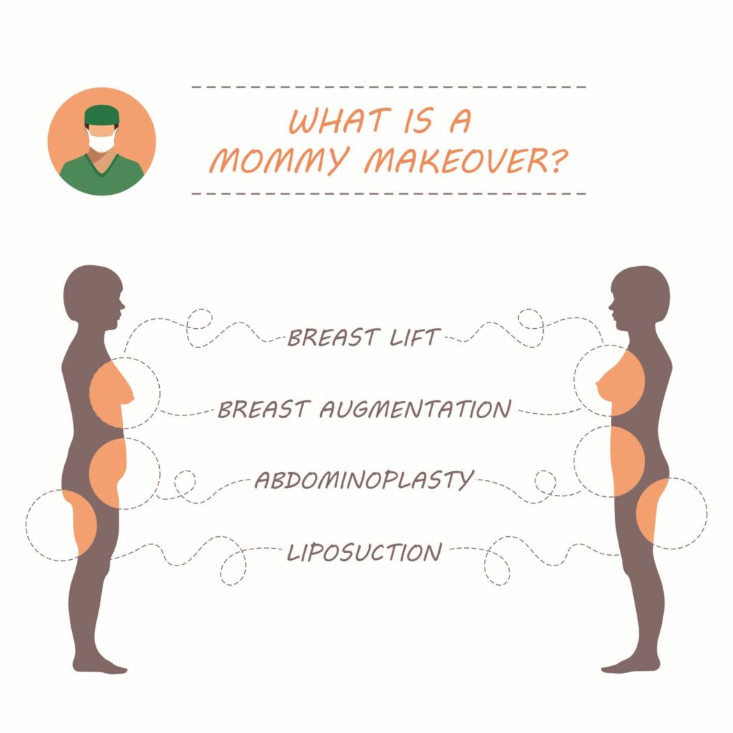 mommy makeover was wird gemacht, bauchdeckenstraffung, bruststraffung, brustvergrößerung, fettaubsaugung nach geburt 